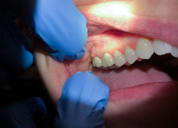 Best Holiday Emergency Dentist in White Knoll, SC
