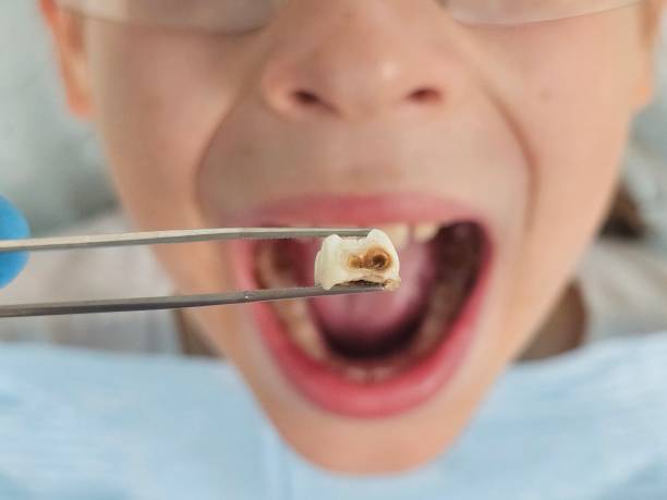 Best Orthodontic Emergency Dentist in White Knoll, SC