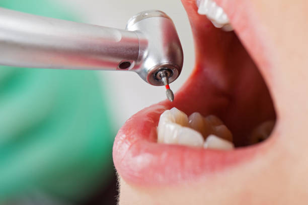 Best Pediatric Emergency Dentist in White Knoll, SC
